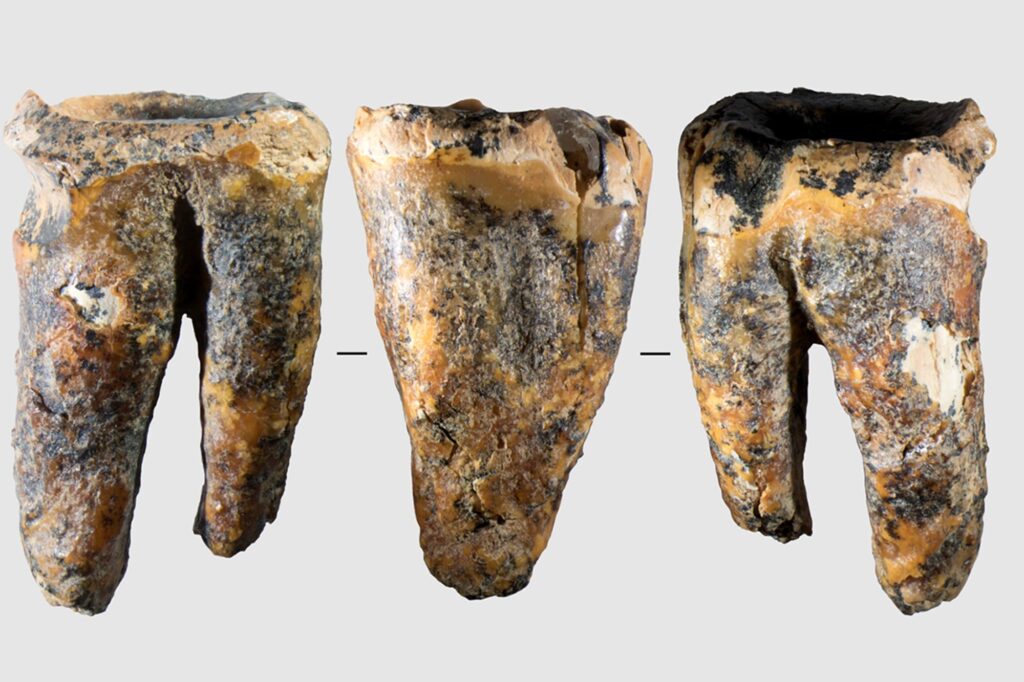 Hallan en Siberia un diente con tratamiento de caries de 59.000 años