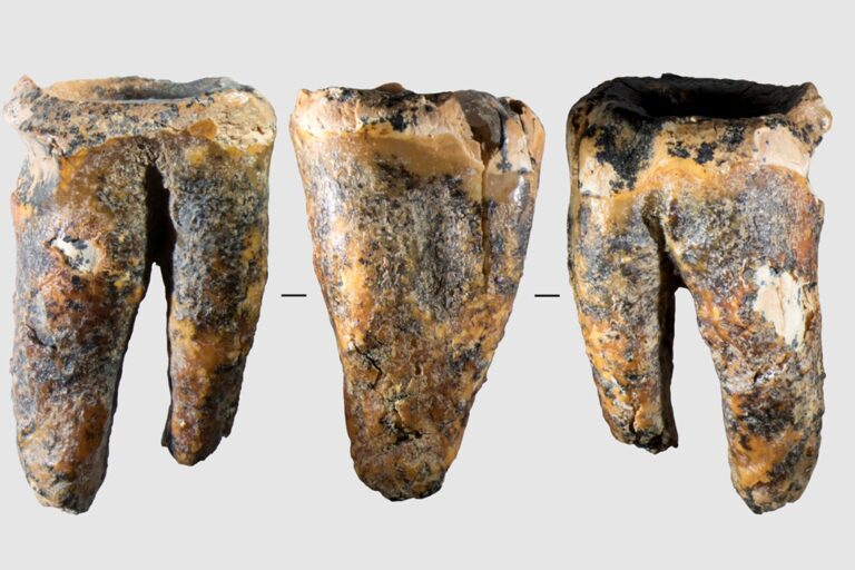 Hallan en Siberia un diente con tratamiento de caries de 59.000 años