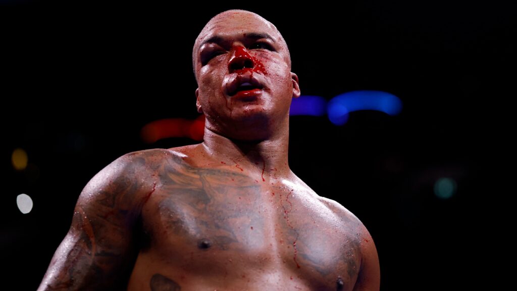 Imagen editorial relacionada con: Daniel Dubois recuperó el título mundial OMB tras un sangriento nocaut técnico ante Fabio Wardley