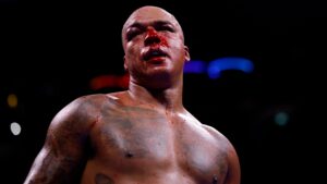 Imagen editorial relacionada con: Daniel Dubois recuperó el título mundial OMB tras un sangriento nocaut técnico ante Fabio Wardley