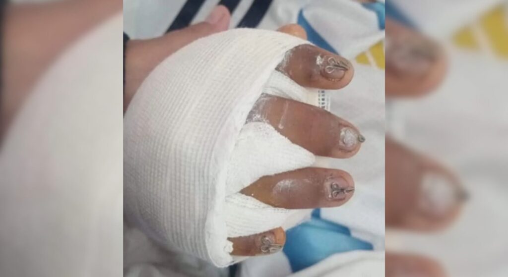 Denuncian abandono de persona tras grave accidente escolar en Jujuy