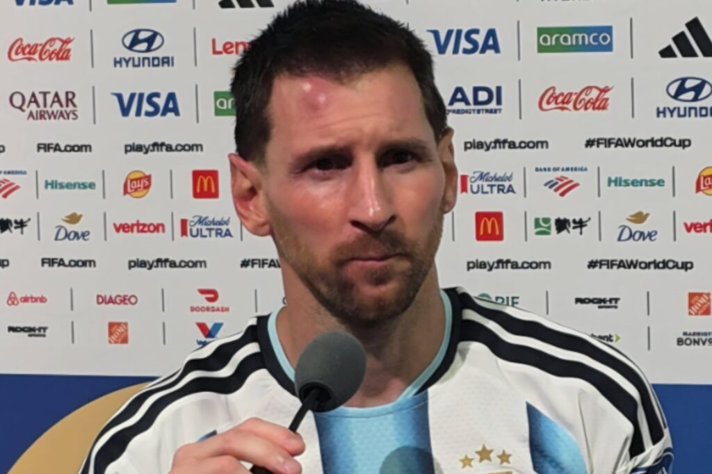Messi sufrió un fuerte golpe en la frente en el triunfo ante Cabo