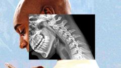 Cuerpo de teléfono: advierten por daños óseos y pérdida de fuerza